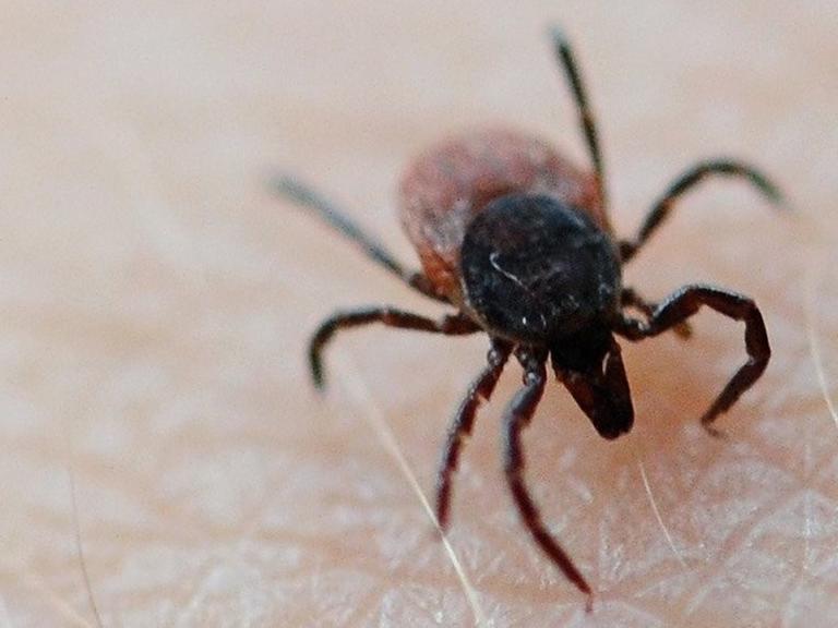 Zu sehen ist eine Zecke auf der Haut eines Menschen. Zu sehen ist eine Zecke auf der Haut eines Menschen.