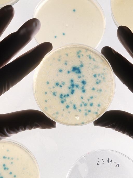 Zwei Hände fassen eine Petrischale mit Bakterienkulturen zur Genvermehrung.