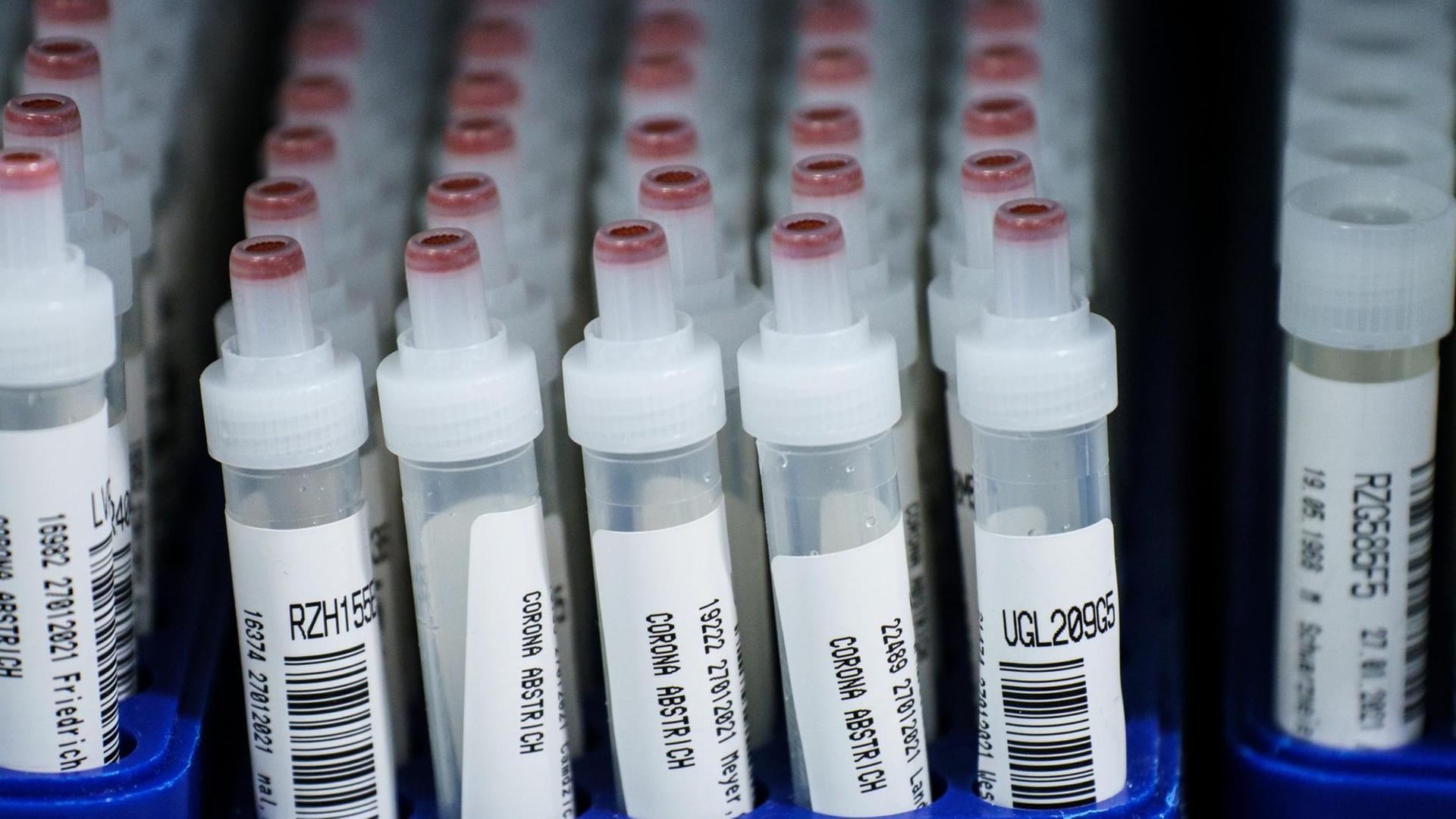 Kunststoffröhrchen mit Corona-Abstrichen nach PCR-Test im Großlabor von Bioscientia