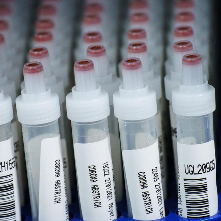 Kunststoffröhrchen mit Corona-Abstrichen nach PCR-Test im Großlabor von Bioscientia