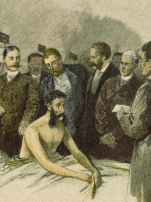 Ein Holzstich, koloriert, nach Zeichnung von Hermann Lueders (1836-1908) aus dem Jahr 1890 zeigt Robert Koch umgeben von Ärzten beim Impfen eines Mannes.