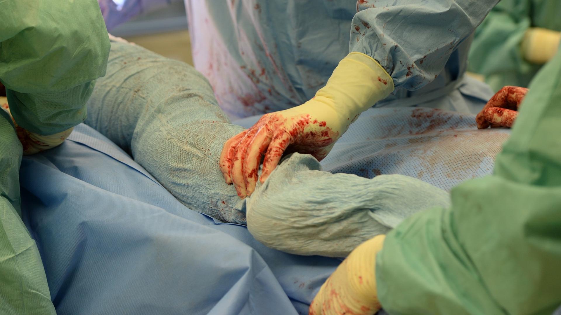 Ein Mediziner-Team operiert in einer Klinik in Baden-Württemberg eine Hüfte.