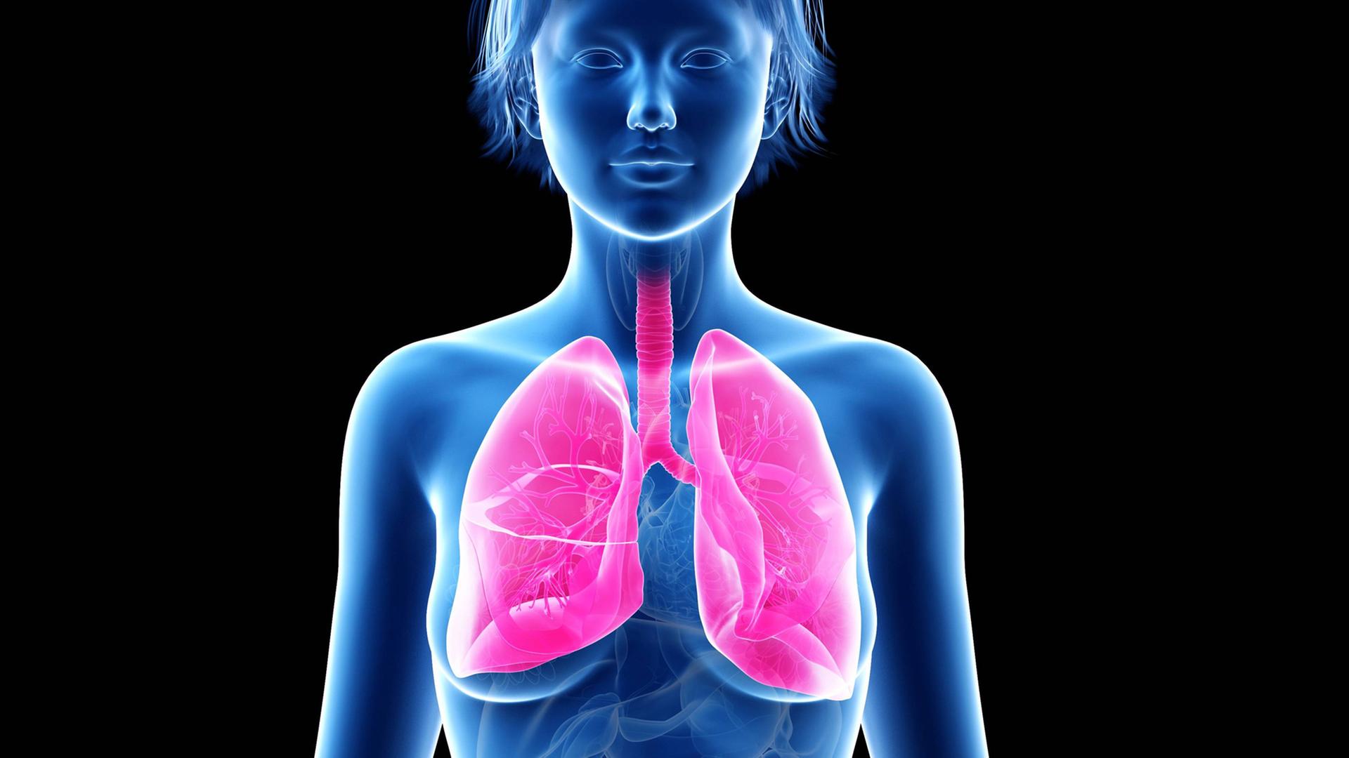 Die Illustration zeigt eine weibliche Lunge: Die Lymphangioleiomyomatose ist eine Erkrankung, die nur bei Frauen auftritt.