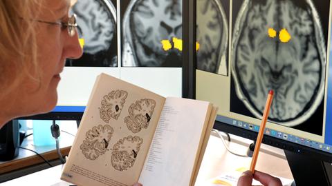 Die wissenschaftliche Mitarbeiterin des Projektes Neurobiologie des Übergewichtes am Max-Planck-Institut für Kognitions- und Neurowissenschaften, Dr. Annette Horstmann, vergleicht Ergebnisse von im MRT erstellten Hirnstrukturen und Funktionen, die zum Beispiel auf Essensreize dargestellt werden, aufgenommen am 02.11.2011.