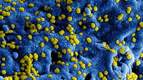 HANDOUT - Produced by the National Institute of Allergy and Infectious Diseases (NIAID), this highly-magnified, digitally-colorized scanning electron micrograph (SEM) reveals ultrastructural details at the site of interaction of numerous yellow-colored Middle East respiratory syndrome Coronavirus (MERS-CoV) viral particles that were on the surface of a Vero E6 cell, which had been colorized blue. MERS-CoV was identified in 2012 as the cause of respiratory illness in people. Investigations are being done to figure out the source of MERS-CoV and how it spreads. So far, there are no reports of anyone in the U.S. getting infected with MERS-CoV. Most people who got infected with MERS-CoV developed severe acute respiratory illness with symptoms of fever, cough, and shortness of breath. About half of them died. Some people were reported as having a mild respiratory illness. MERS-CoV has been shown to spread between people who are in close contact. Transmission from infected patients to healthcare personnel has also been observed. Clusters of cases in Saudi Arabia, Jordan, the UK, France, Tunisia, and Italy are being investigated. Photo: National Institute of Allergy and Infectious Diseases (NIAID) 2014/dpa (ACHTUNG: Nur zur redaktionellen Verwendung im Zusammenhang mit der aktuellen Berichterstattung und nur bei Nennung: "Foto: National Institute of Allergy and Infectious Diseases (NIAID) 2014/dpa"; zu: "Mann aus Region Osnabrück mit tödlichem Mers-Virus infiziert" vom