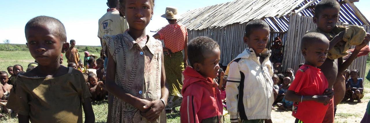 Mangelernährte Kinder stehen in der Gemeinde von Shanamaro in einer Reihe.
