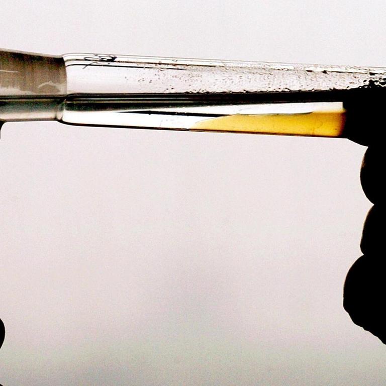 Eine Laborantin dekantiert am 16.02.2004 im Institut für Biochemie in der Sporthochschule in Köln eine Urin-Dopingprobe. 