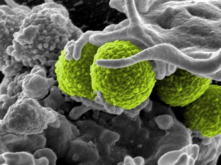 Staphylococcus aureus-Bakterien (grün) werden von einer großen menschlichen Blutzelle (grau) umschlossen.