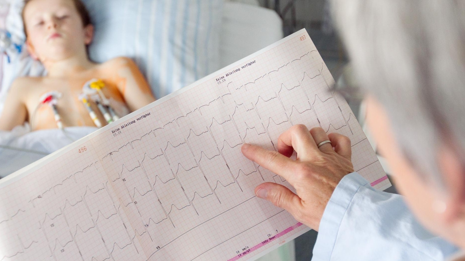 Кардиограмма сердца ребенку. Экг плода. Феномен венкебаха. Экг новорожденного норма. Феномен венкебаха.