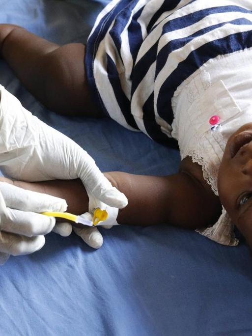 Ein Kind leidet an Malaria, Aufnahme aus Bweyale, Uganda