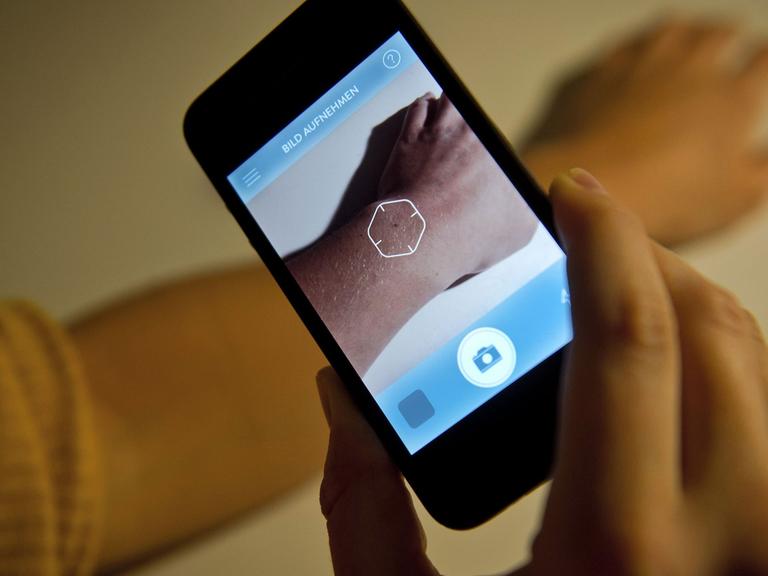 Eine Frau fotografiert mit der App "Goderma" ein Muttermal.
