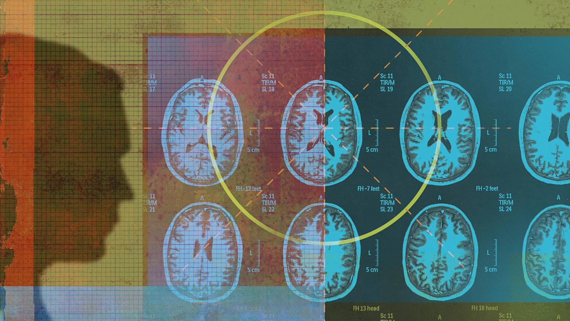 Ein Mann analysiert MRT-Scans. (Illustration) Ein Mann analysiert MRT-Scans. (Illustration)