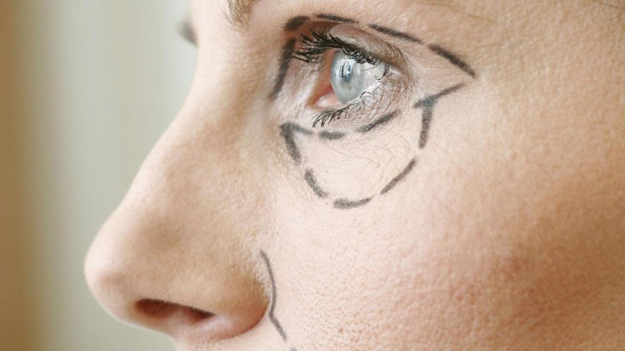 Gesicht einer Frau, die Augen und Nase sind von einem Schönheitschirurgen mit schwarzem Stift gekennzeichnet worden.