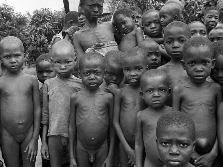 Die hungernden Kinder von Biafra schockierten die Welt - Biafra wurde zum Synonym für Elend, Hunger, Verzweiflung und Massensterben