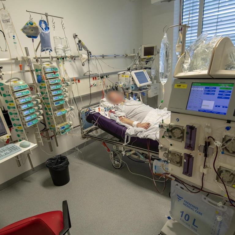 Ein Patient liegt während seines Aufenthalt im Krankenhaus Großhadern in einem Intensivzimmer an einem Beatmungsgerät und einem Dialysegerät.  