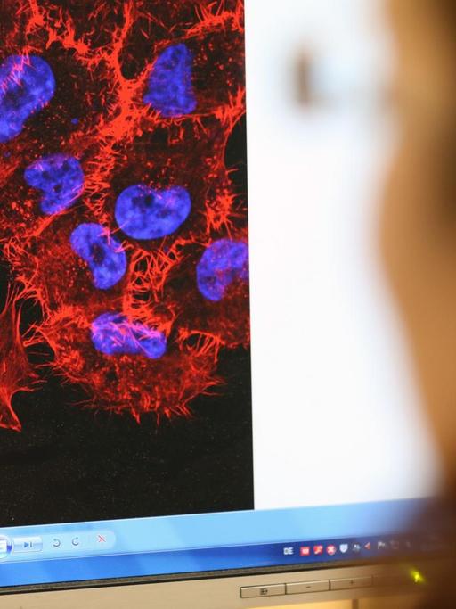 Im Labor des Instituts für Experimentelle Gentherapie und Tumorforschung (IEGT) der Universitätsmedizin Rostock (Mecklenburg-Vorpommern) schaut eine Doktorandin am 22.10.2013 auf ein Monitorbild von Melanom-Zellen (schwarzer Hautkrebs).