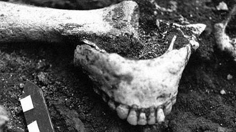 Unterkiefers eines Steinzeitmenschen, der im Sommer 1991 in Dmanisi, Südgeorgien, gefunden wurde. Die Entdeckung der etwa 1,8 Millionen Jahre alten Knochen galt damals als Sensation.