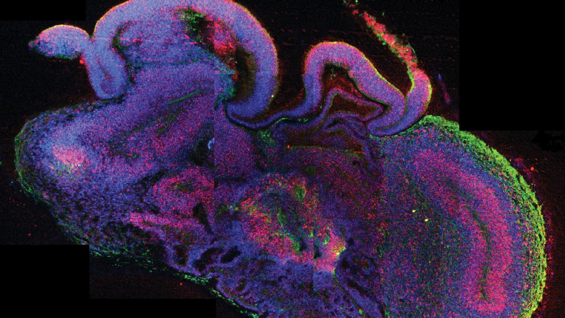 Die undatierte mikroskopische Querschnittsaufnahme eines ganzen cerebralen Organoids zeigt die Entstehung verschiedener Hirnregionen. Die etwa vier Millimeter großen dreidimensionalen Modelle bilden die frühe Entwicklung des menschlichen Gehirns nach. Ausgangspunkt für die Versuche eines waren zunächst embryonale Stammzellen.