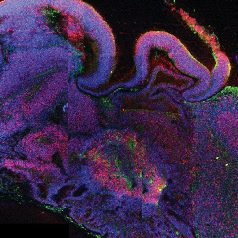Die undatierte mikroskopische Querschnittsaufnahme eines ganzen cerebralen Organoids zeigt die Entstehung verschiedener Hirnregionen. Die etwa vier Millimeter großen dreidimensionalen Modelle bilden die frühe Entwicklung des menschlichen Gehirns nach. Ausgangspunkt für die Versuche eines waren zunächst embryonale Stammzellen. 