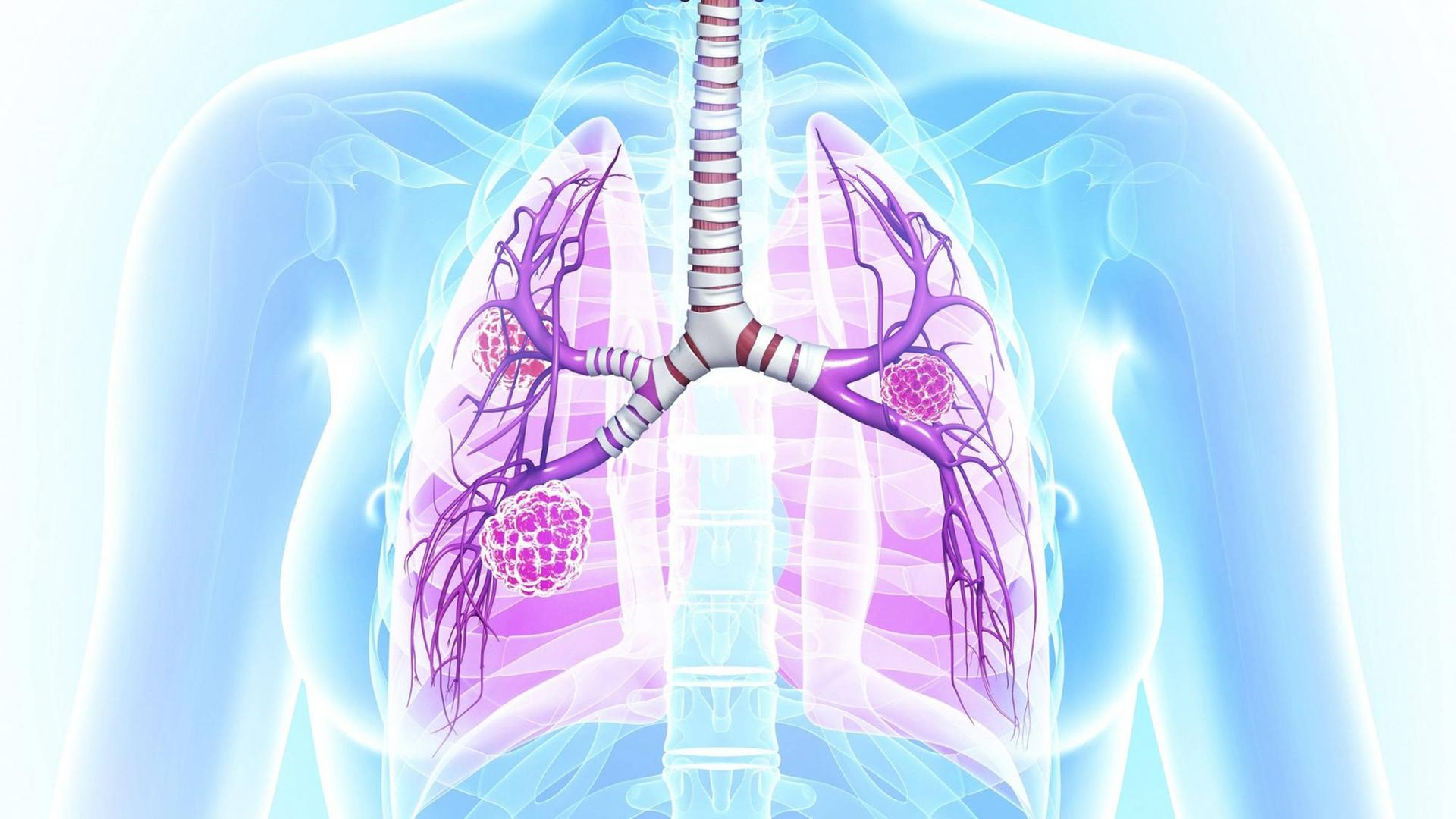 Die Grafik der Lungen einer Frau.
