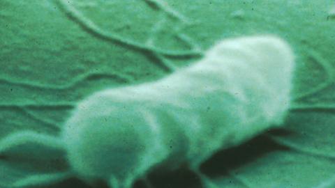 Salmonellen sind die Spitzenreiter unter den Erregern von Lebensmittelvergiftungen