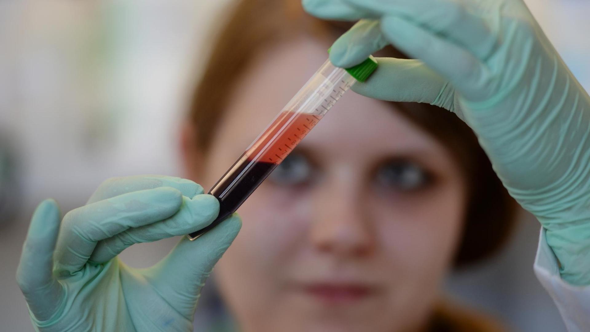 Eine Medizinisch-Technische Assistentin hält eine Blutprobe zur Prüfung in die Höhe.