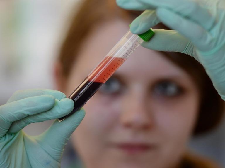 Eine Medizinisch-Technische Assistentin hält eine Blutprobe zur Prüfung in die Höhe.