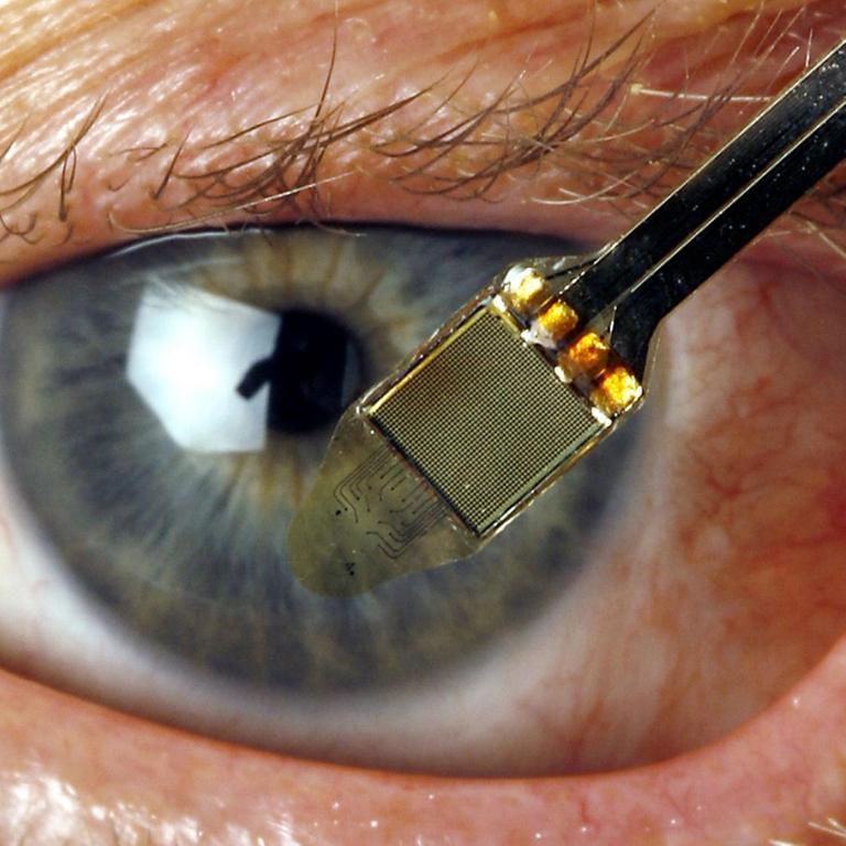 Eine Person hält am Dienstag in der Universitätsklinik Tübingen einen Chip vor das Auge des blinden Hartwig Lahann, der Ende 2006 für fünf Wochen einen baugleichen Chip in sein Auge implantieren ließ.