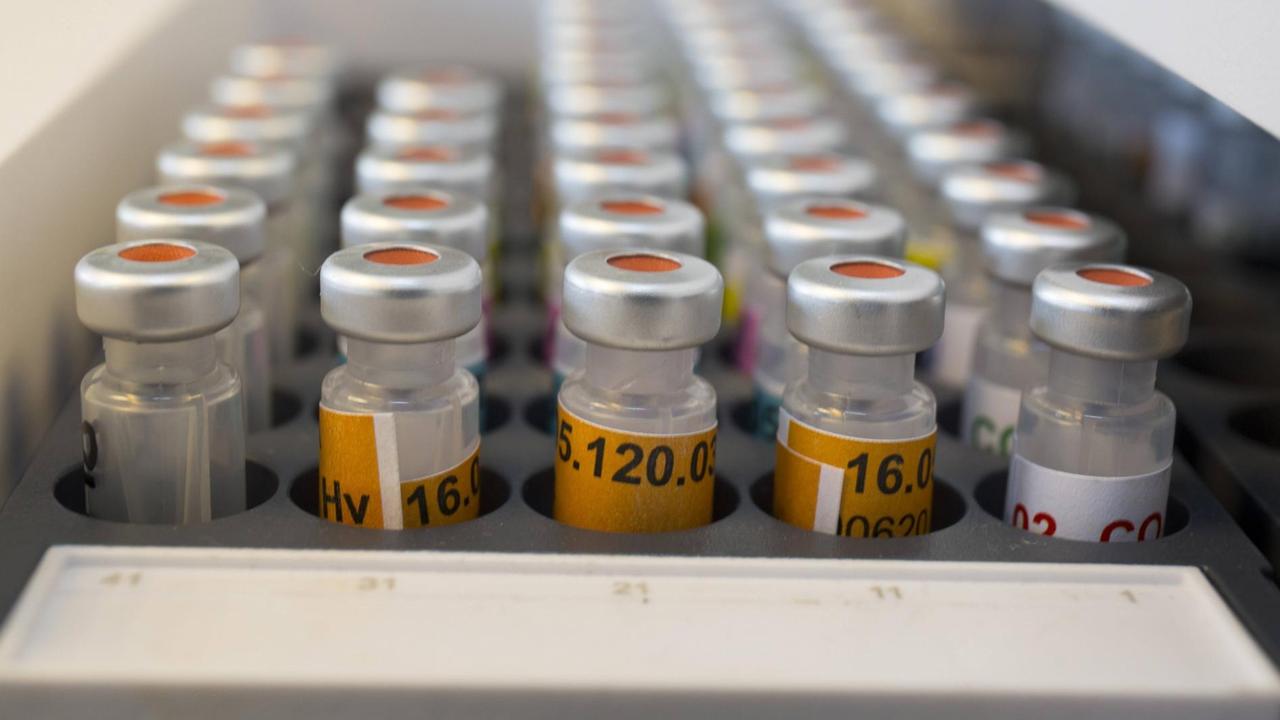 Dopingproben in einem Labor.