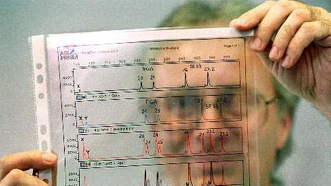 Ein Mitarbeiter des Landeskriminalamtes Sachsen betrachtet im Labor des LKA in Dresden eine grafische Umsetzung einer DNA-Analyse