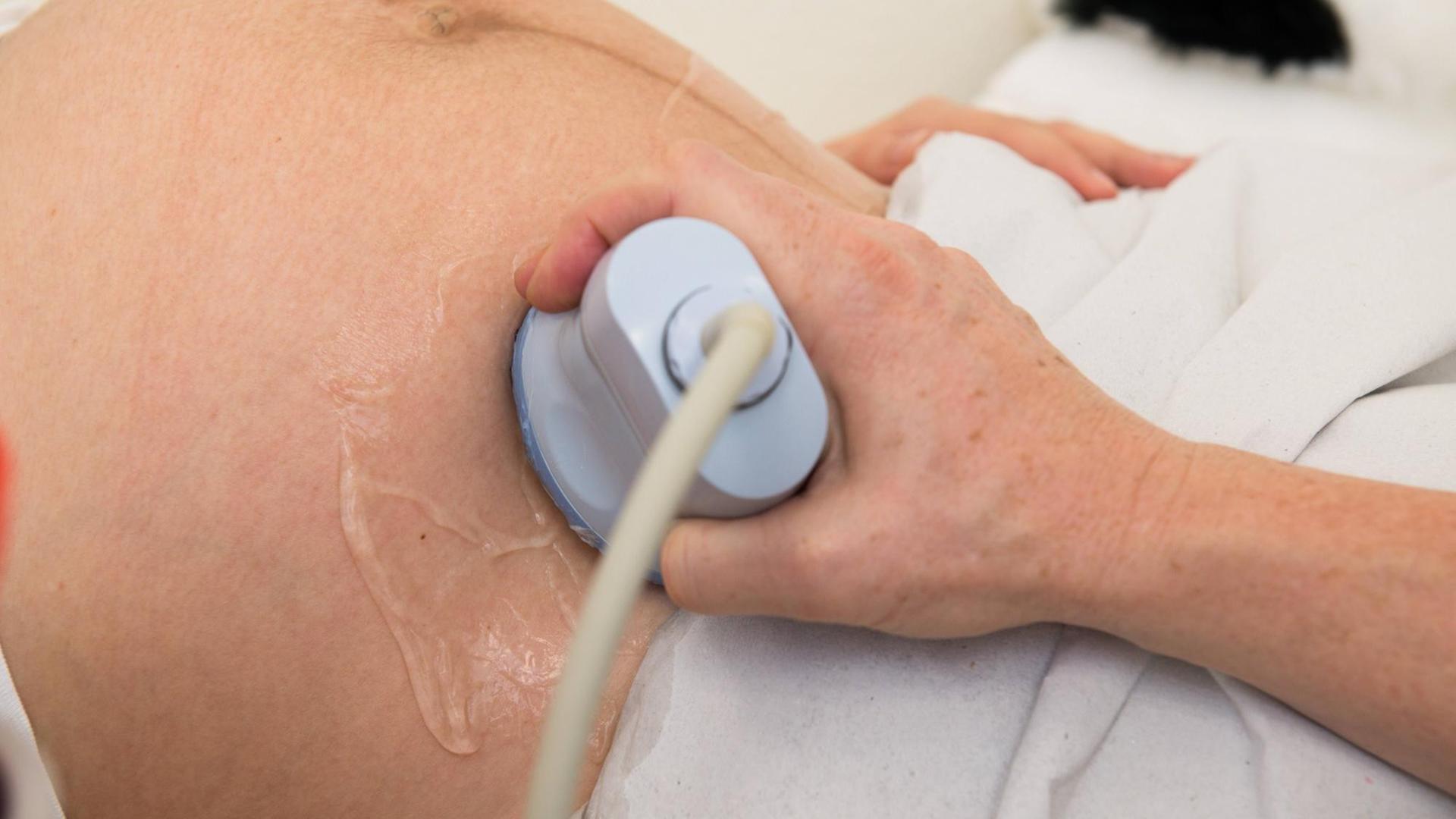 Ultraschall-Untersuchung einer Schwangeren Babyscreening *** Ultrasound examination of a pregnant woman Babyscreening