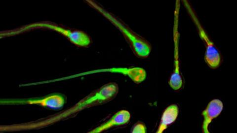 Männliche Samenzellen unter dem Mikroskop.