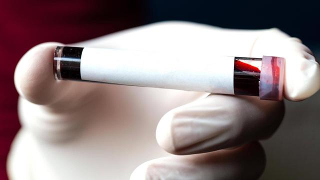 Eine Hand hält eine Röhre. In der Röhre ist eine kleine Menge Blut.
