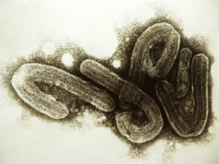 Archivaufnahmen von Ebola-Viren