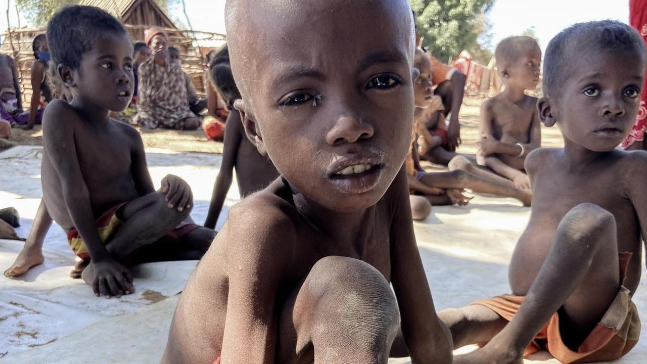 Sehr dünne Kinder in Madagaskar.