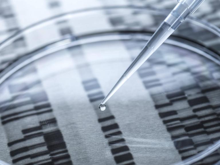 Das Foto zeigt eine Petrischale mit einer Pipette, unter der durchsichtigen Petrischale sieht man eine Aufnahme von DNS Sequenzen.