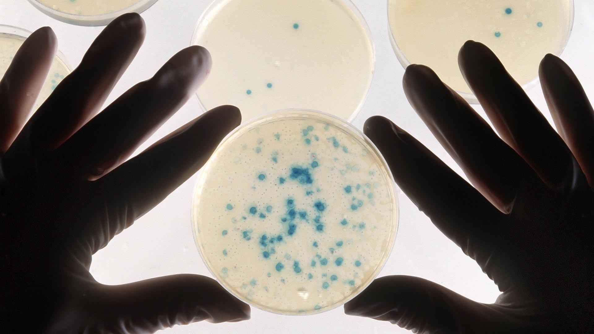 Petrischalen mit Bakterienkulturen