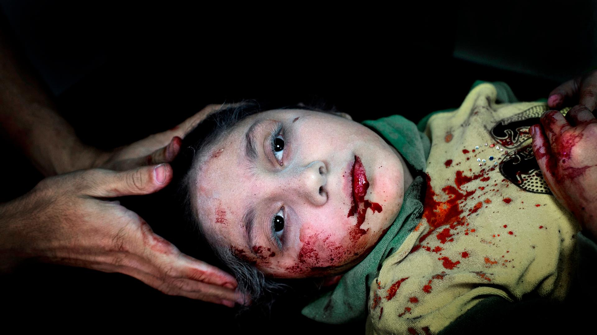 Aleppo, Syria. Dar al-Shifa hospital. FSA-Free Syrian Army.
Dania Kilsi, 11, is treated for shrapnel wounds in Dar al-Shifa hospital in Aleppo. She and her two younger siblings, Zaid, 2 and Fatima 6, were playing outside their home when they got injured f