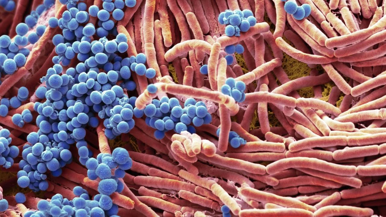 Mikroskopaufnahme von Bakterien. Sehen aus wie blaue Kügelchen und rosafarbene längliche Würstchen. 