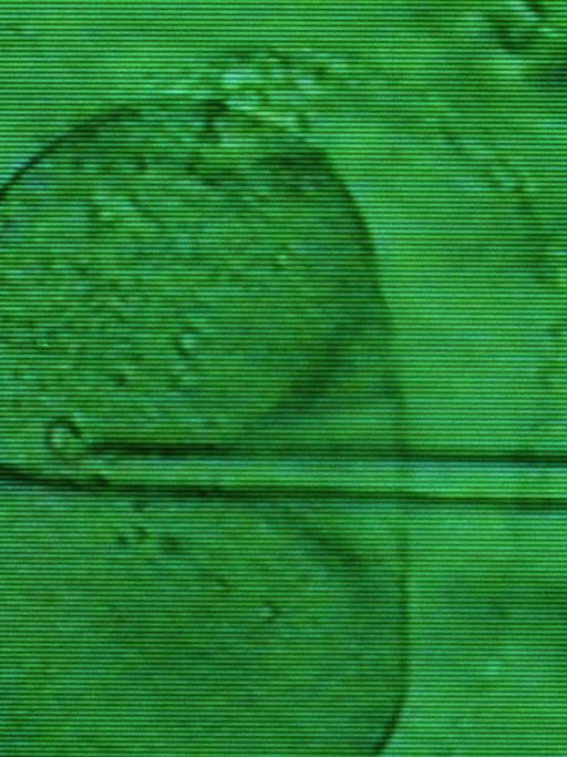 Das Monitorfoto zeigt das Einbringen einer Samenzelle in eine Eizelle mittels Mikropipette unter dem Mikroskop.