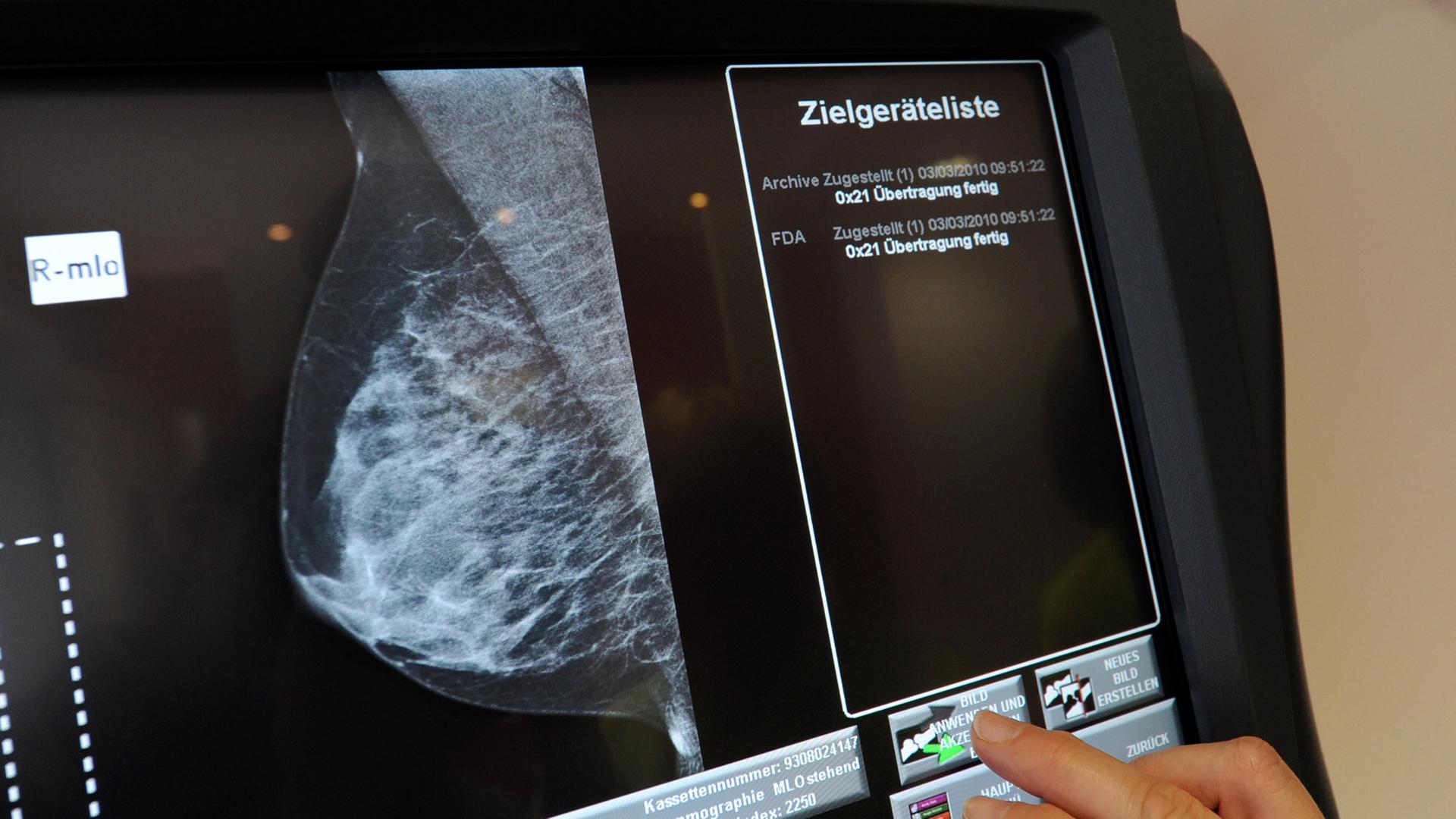 Eine medizinisch-technische Radiologieassistentin überprüft eine Aufnahme einer Brust.