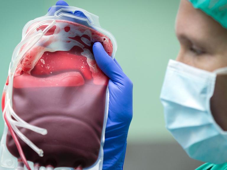 Eine Ärztin hält einen Beutel mit Erythrozyten-Konzentrat - im Volksmund "Blutkonserve" genannt.