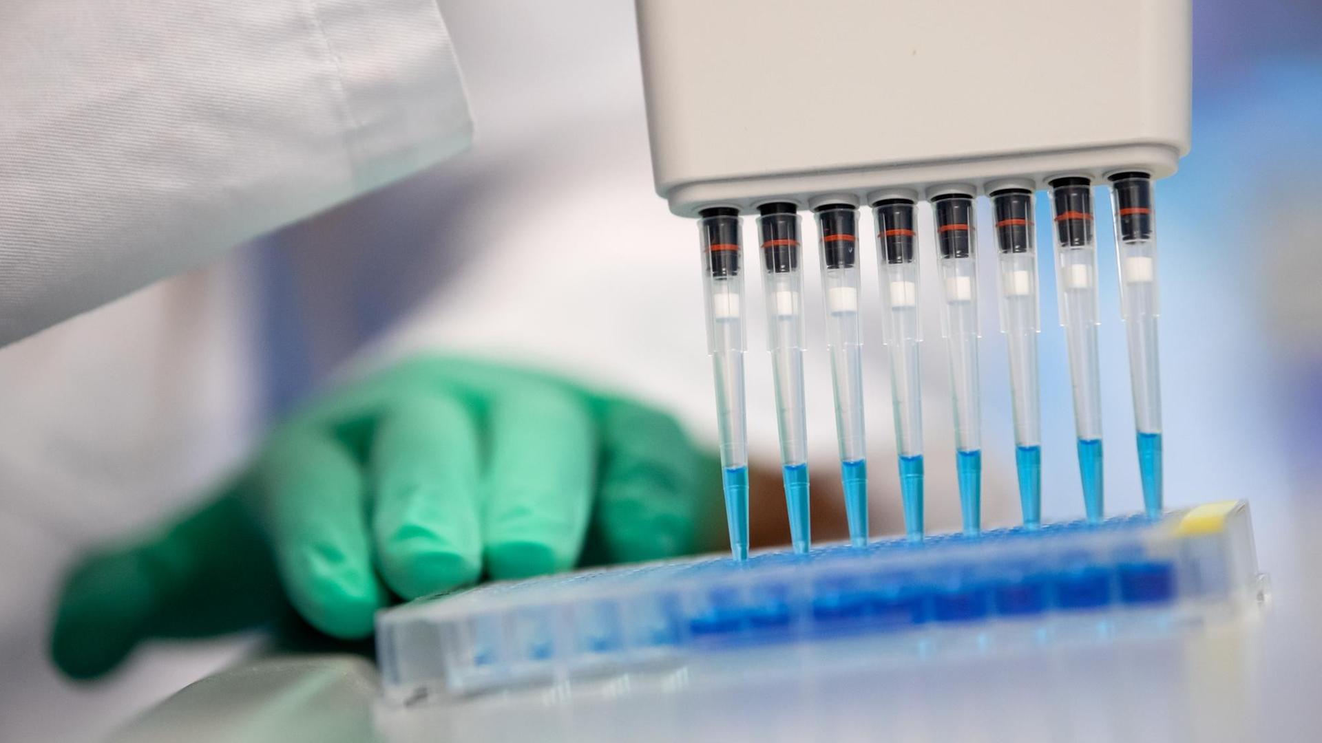 Eine Mitarbeiterin am Institut für Virologie der technischen Universität München (TUM) pipettiert in einem Labor einen Ansatz zum Proteinnachweis.