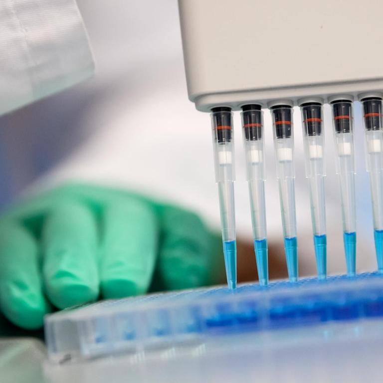 Eine Mitarbeiterin am Institut für Virologie der technischen Universität München (TUM) pipettiert in einem Labor einen Ansatz zum Proteinnachweis.