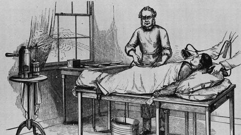 Operation von 1882: Der Chirurg entfernt hier Eierstöcke bei einer weiblichen Patientin
