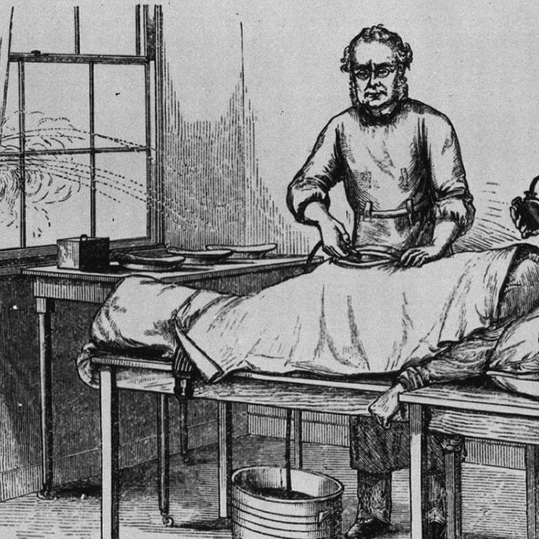 Operation von 1882: Der Chirurg entfernt hier Eierstöcke bei einer weiblichen Patientin