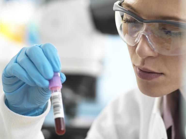 Eine Laborantin hält ein Röhrchen mit Blut in der Hand.