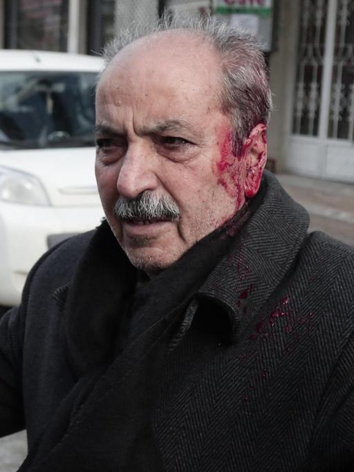 Ein verletzter kurdischer Demonstrant