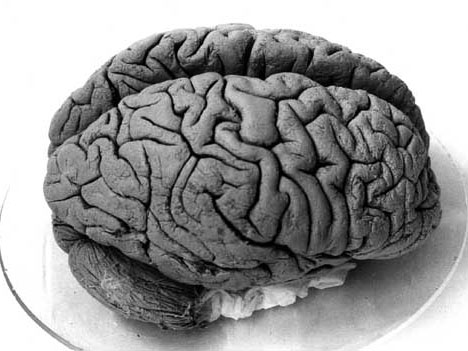 Das menschliche Gehirn ist eine immer noch nicht vollkommen verstandene Maschine.