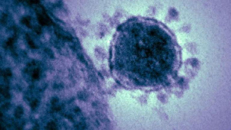 Das Corona-Virus vom Typ 2019-nCoV – auch bekannt als Wuhan-Virus.